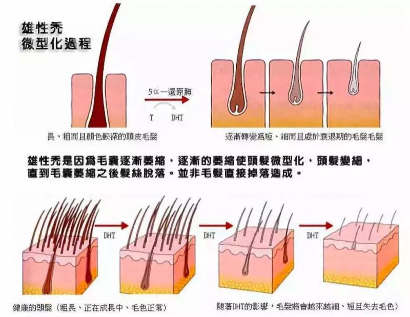 植发适合什么样的人群