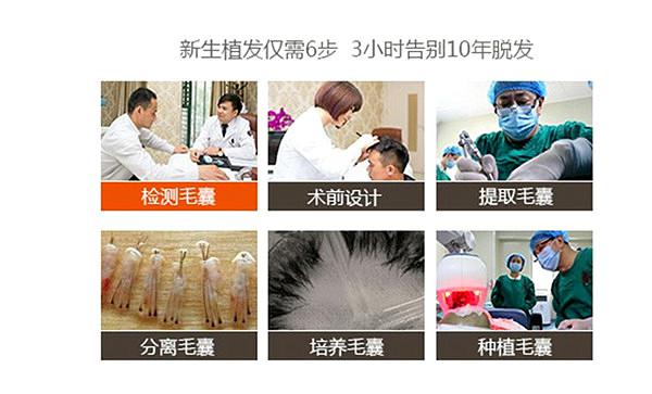 南京治疗脱发的植发医院--南京新生植发