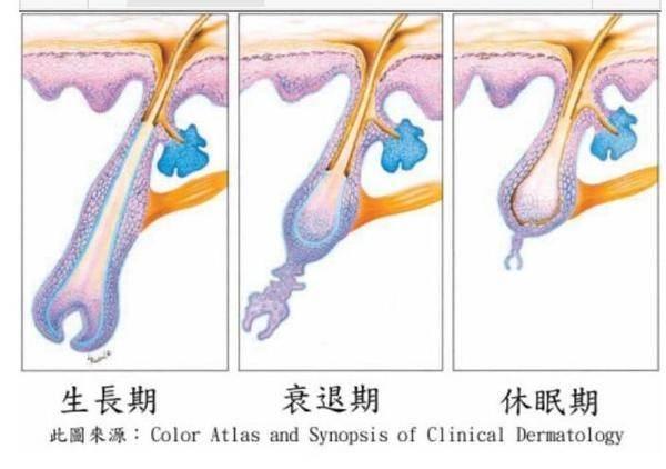 植发是如何进行的呢？