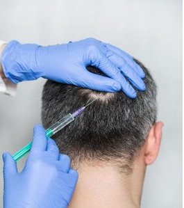 疤痕植发会影响到毛囊的成活率吗？