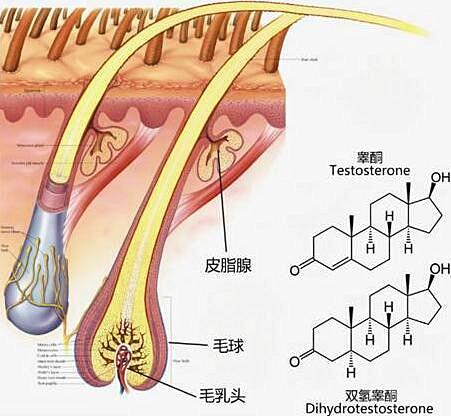 新生提示各位发友：植发时请珍惜每一个毛囊