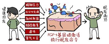 激光治疗脱发，照一照就能治脱发？