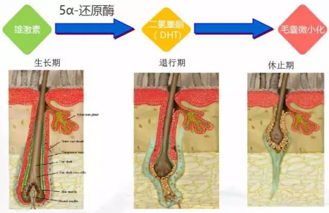 不用药，如何让稀疏的头发变浓密？