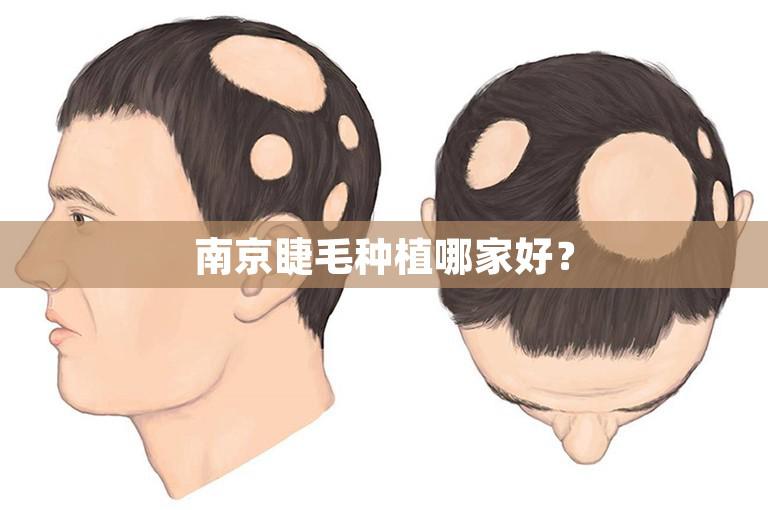 南京睫毛种植哪家好？