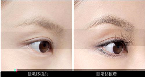南京睫毛嫁接和睫毛种植有什么不同？