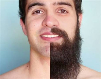 生物素对胡须生长有效吗