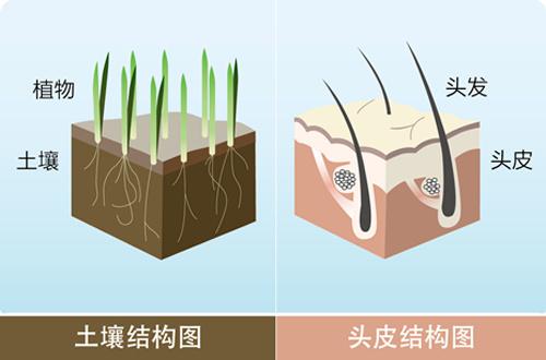 植发之后还需要继续防脱吗？医生说： 需要！