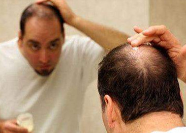 激素治疗脱发的效果怎样，会有危害吗