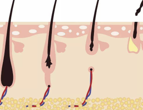 怎么才能看出毛囊有没有闭合