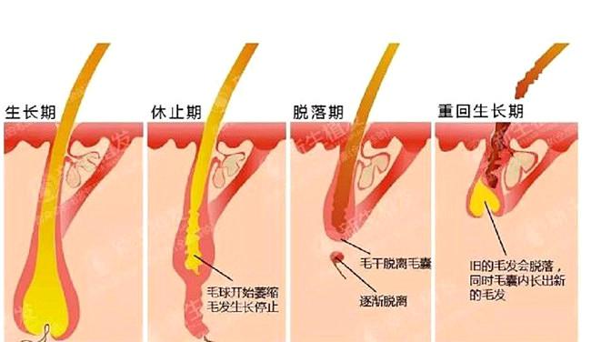 脱发还能有救吗