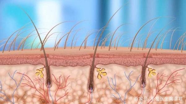 毛囊已经萎缩生发功能不全，你是不是就只能等秃了？