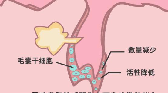 脱发后多久毛囊闭合？我的毛囊还有救吗？