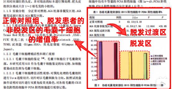 脱发后多久毛囊闭合？我的毛囊还有救吗？