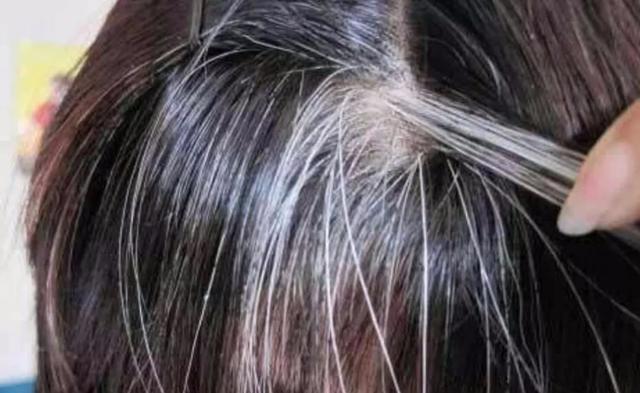 白头发越长越多和什么有关呢？或许缺乏营养元素