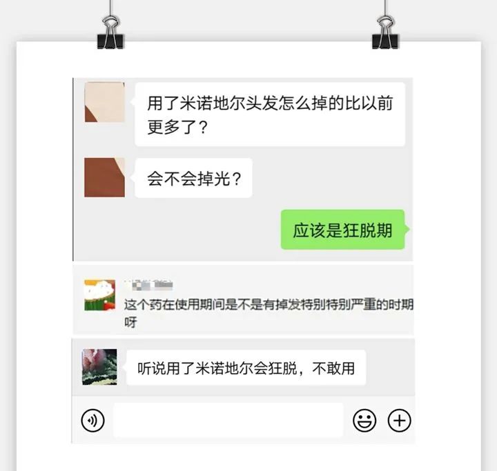 谁用米诺地尔都会有狂脱期吗？狂脱期会持续多久？