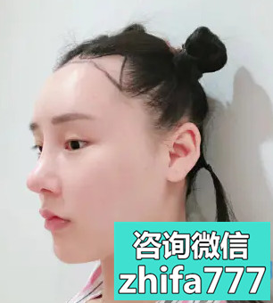 哈尔滨大麦美人尖种植很自然