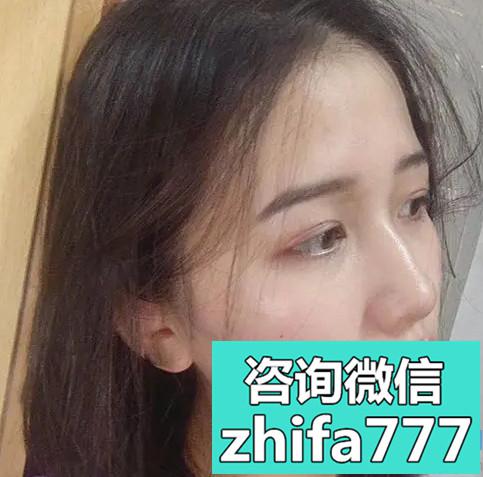 长沙新生美人尖种植，我非常满意！