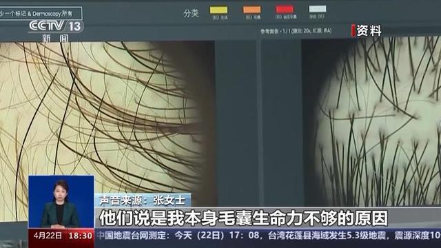 央视曝光植发乱象：存活率成谜、维权难