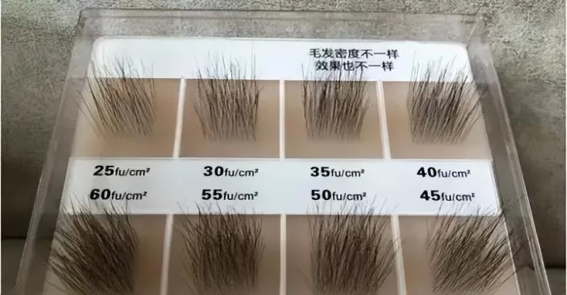 植发3000毛囊一般要多少钱？怎么选靠谱的植发医院？