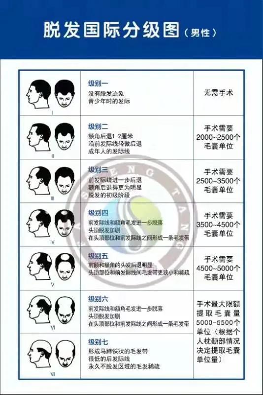 关于头发种植各自技术你不了解的那些事儿？