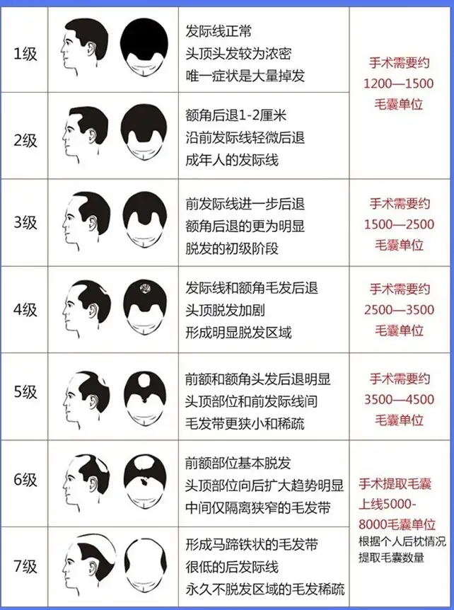 植发贵不贵？植发大概多少钱？看完文章保证你植发不被坑！