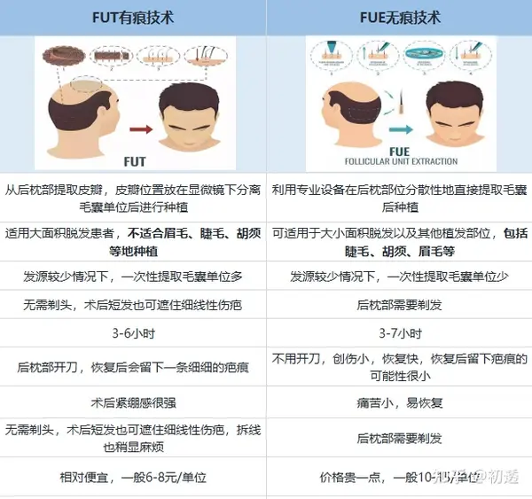 植发到底要多少钱？2万元够吗？