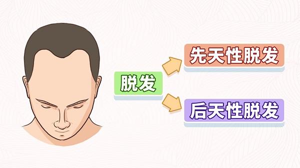 脱发原因大盘点，来看看你属于哪一种？