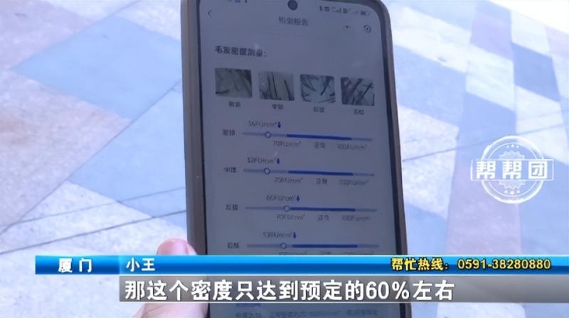 植发效果不如预期，小伙心疼：每一根珍贵如黄金啊