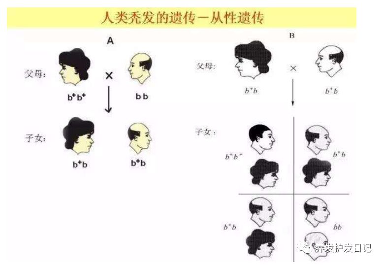 我是码农，请问我该如何应对脱发的烦恼？