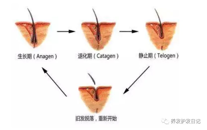 植发的头发真的永久不掉吗？脱落期又是怎么回事？