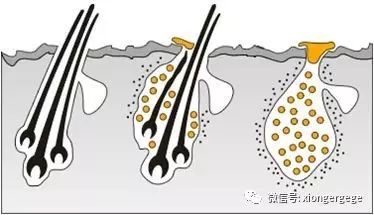 植发行业套路有那些？为什么同样的面积，移植的单位有差别