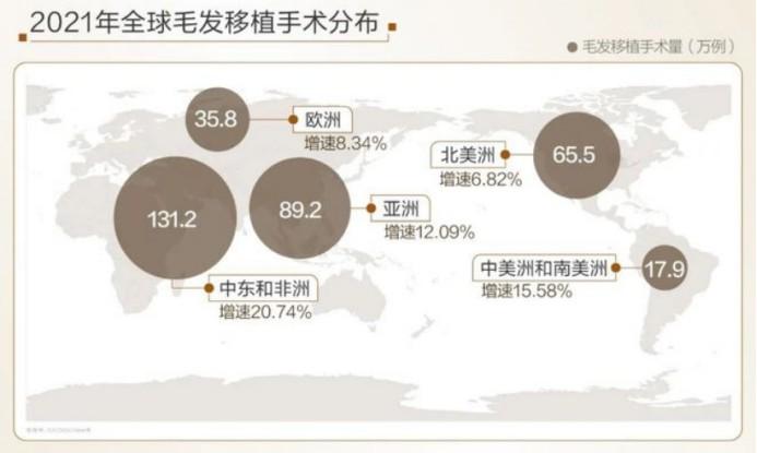 老外为啥更喜欢来中国植发？真相是…