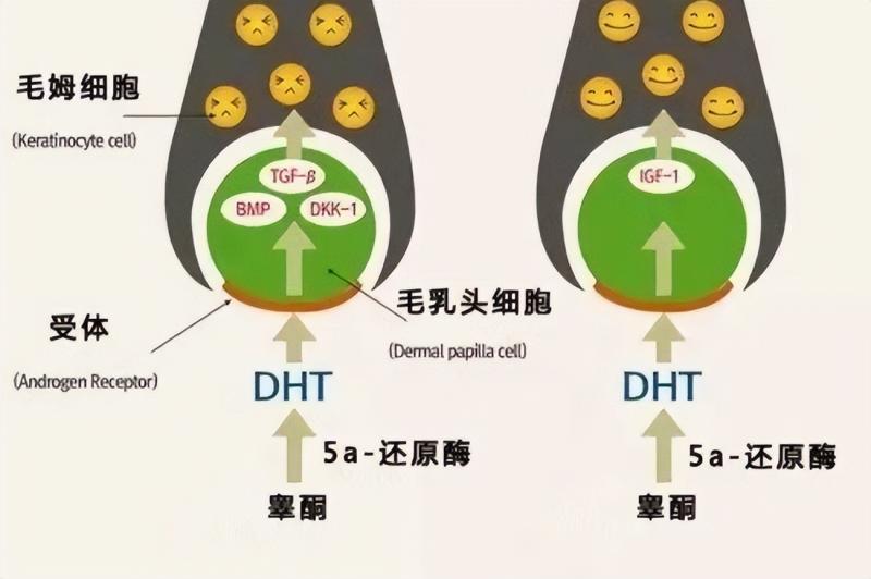 非那雄安是男性雄脱的良药，女性怎么办？