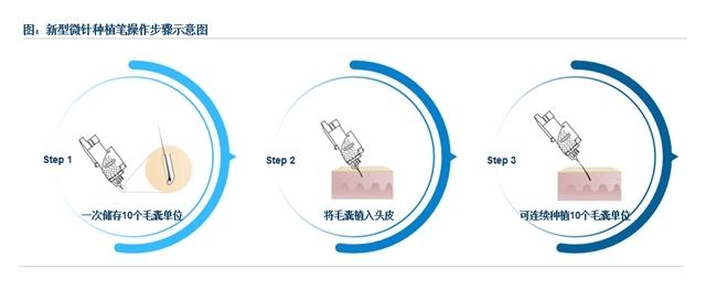 大麦植发发布新型微针植发标准制定白皮书可提速30%