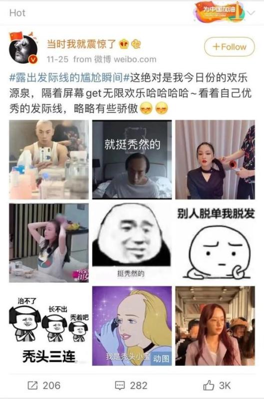 为什么别人的美人线，是你害怕露出的发际线？